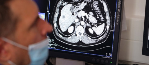 Lubelskie Centrum Onkologii z nowoczesną pracownią brachyterapii